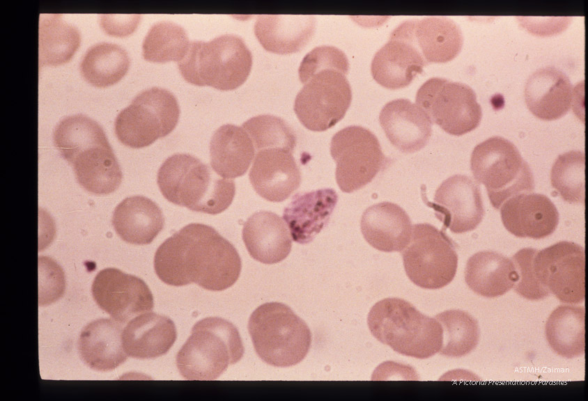 The development of male sexual cells from gametocyte to sperm cells (exflagellation) is shown in this series.