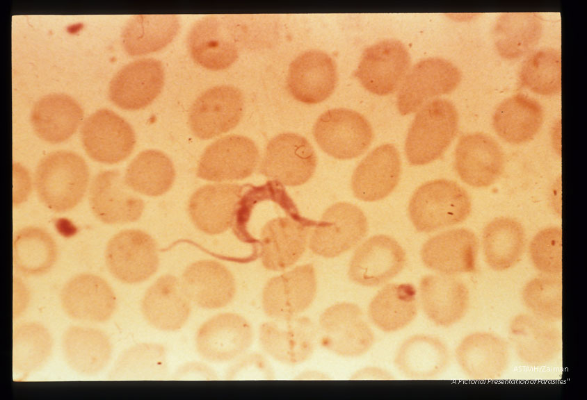 Thin smear of human blood.