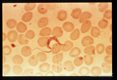Thin smear of human blood.
