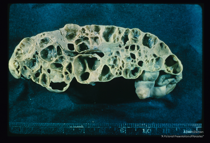 Experimental infection in liver of a muskrat. The multicystic nature of the parasite is well demonstrated in this formalin fixed unstained specimen.