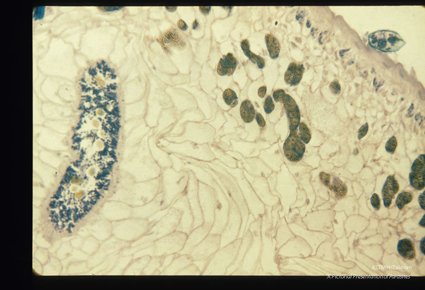 Partial section through periphery of adult.