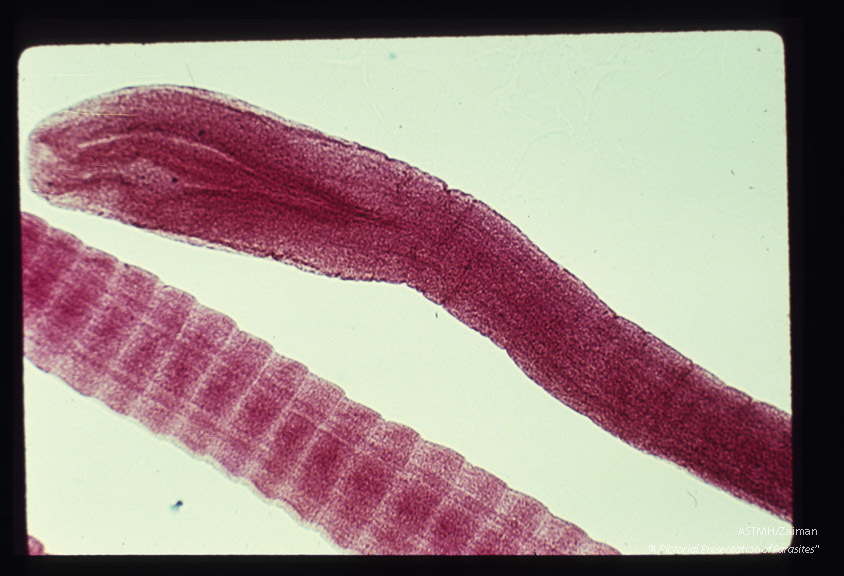 Scolex and immature proglottids. Scolex bears grooves, not suckers.