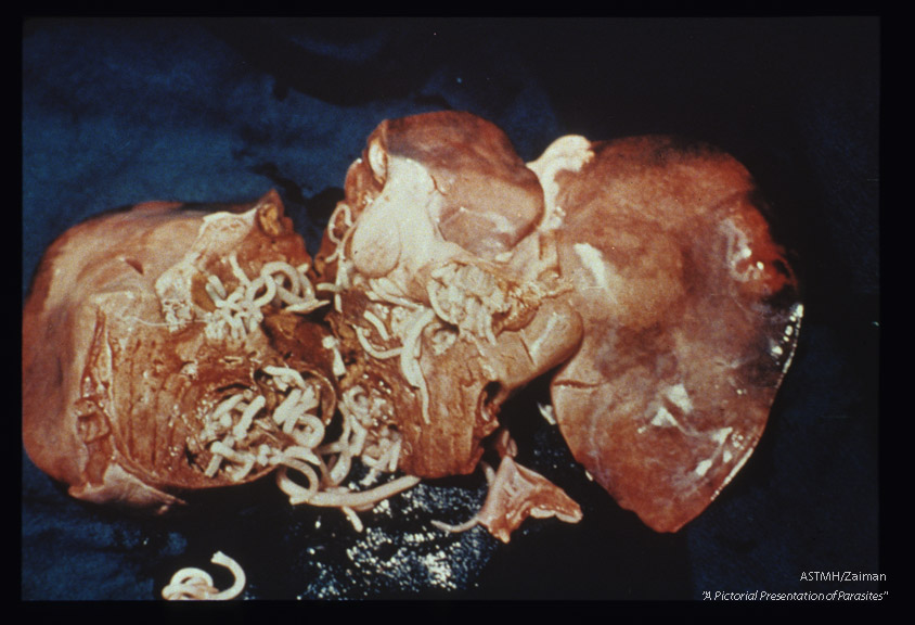 Gross pathology; adults in liver parenchyme.