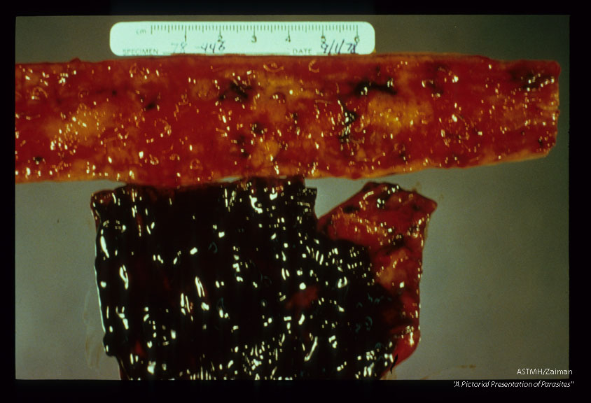 Dog gut showing adults, points of attachment and blood.