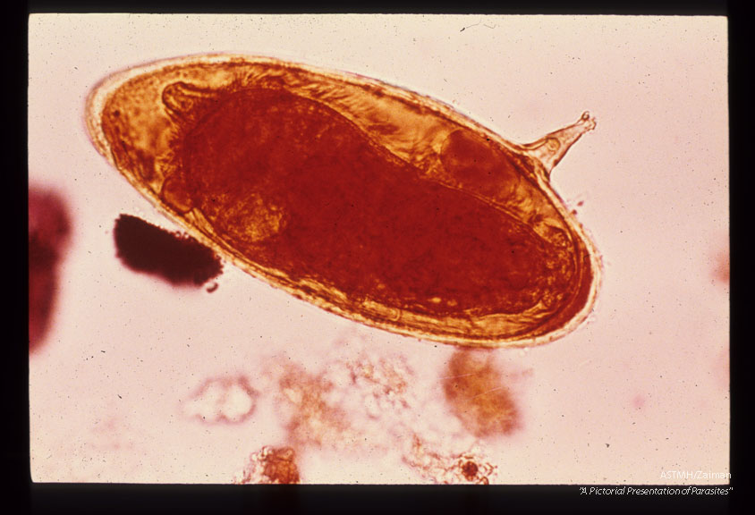Iodine stained egg from stool.