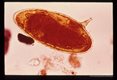 Iodine stained egg from stool.