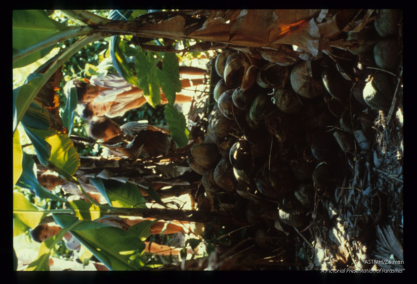 Coconut shells serve as a mosquito breeding place. Vietnam.