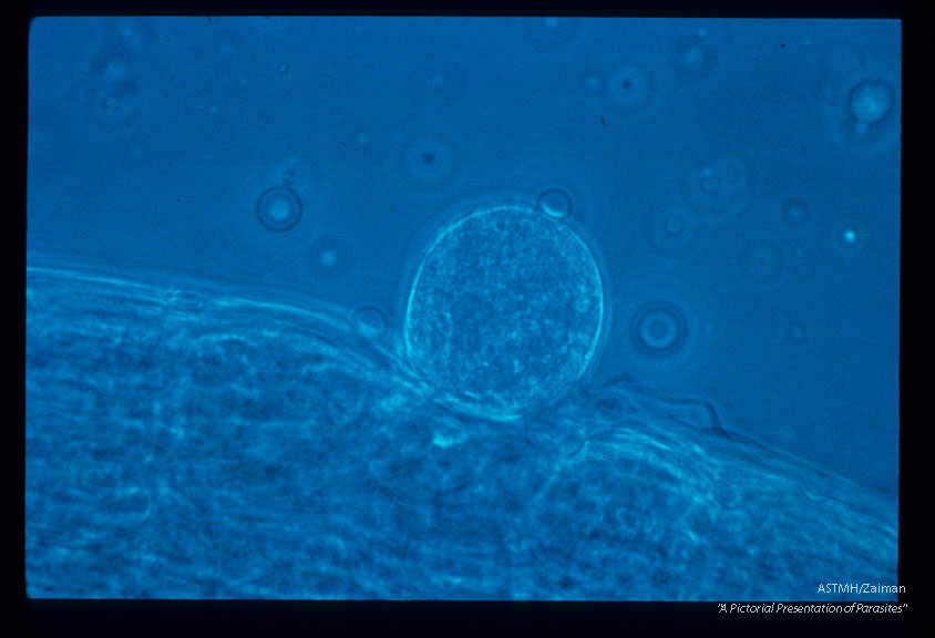 A parasite of wild turkeys. Oocysts on the midgut of the mosquito, Culex pipiens pipiens.