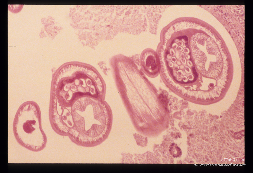 Dog cecum. Cross sections through the thin "lash-like" anterior portion and the thick posterior "handle" are seen. Note musculature of the body wall beneath the cuticle, the gut and the uterus filled with eggs.