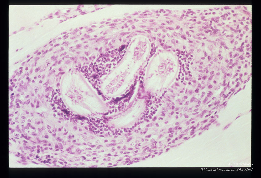 Larval granuloma in skeletal muscle of an experimental hamster.