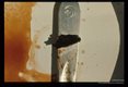 Calcareous flakes from bovine bile duct.