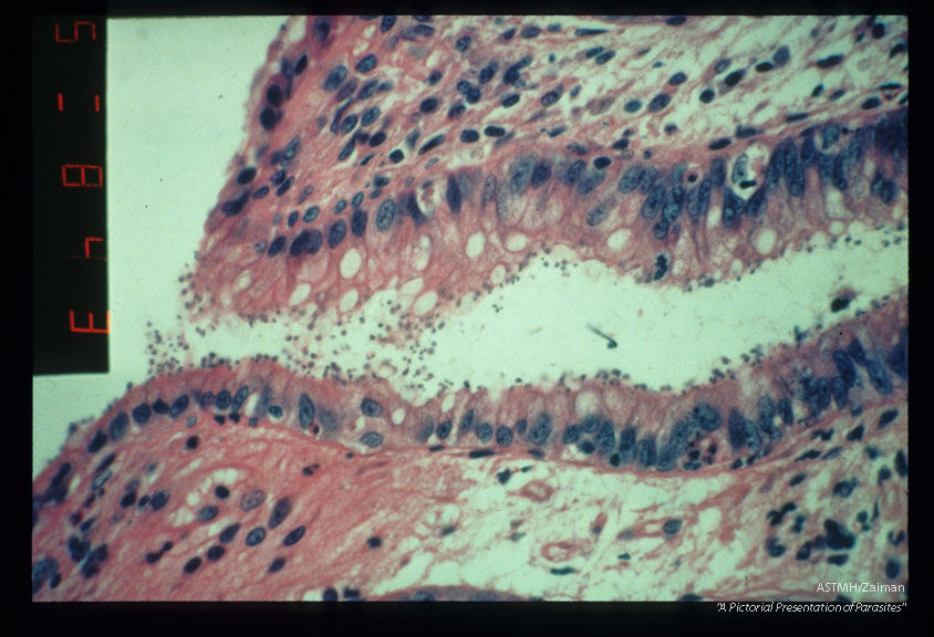 Photomicrographs showing parasites in rectum. H&E stain.