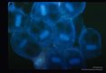 Scolices illuminated with ultra violet light.