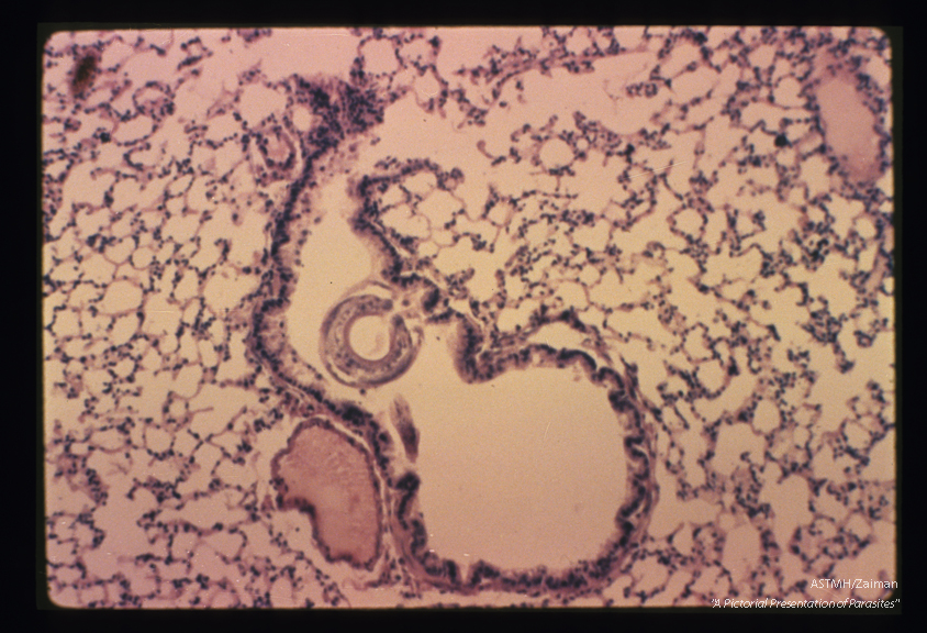 Larva in bronchiole of experimentally infected guinea pig.