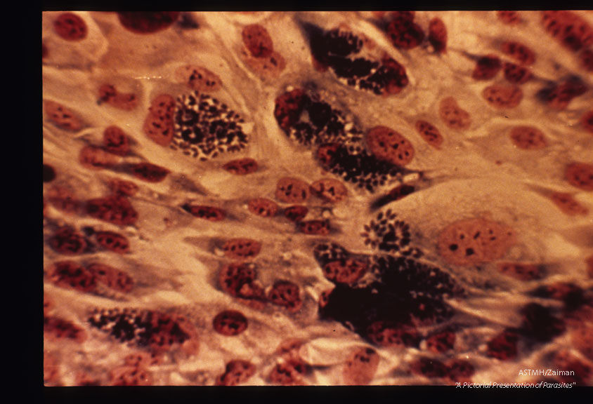 Hela cell culture (monolayer).