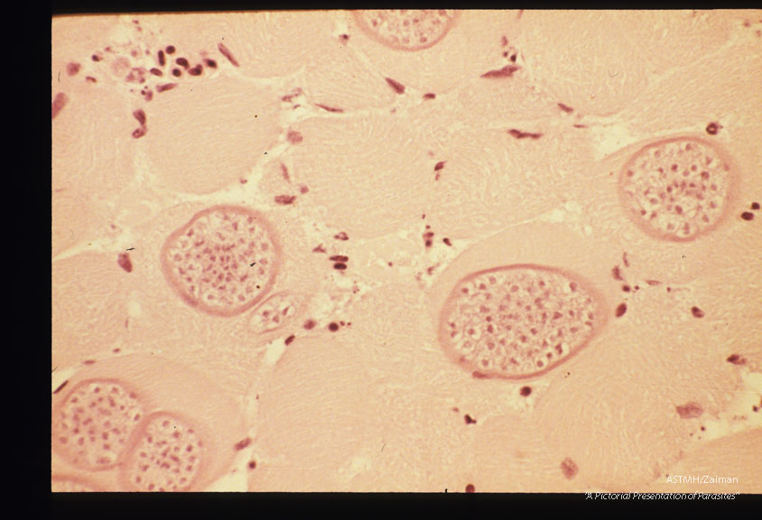 Cysts in leg muscle of budgerigar. 6 weeks PI. Low and high magnifications.