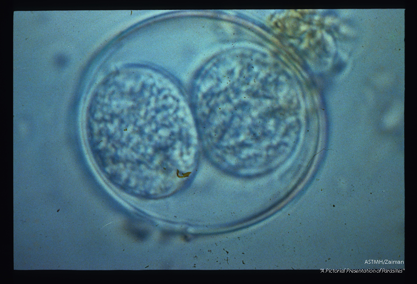 Oocyst with two sporocysts.