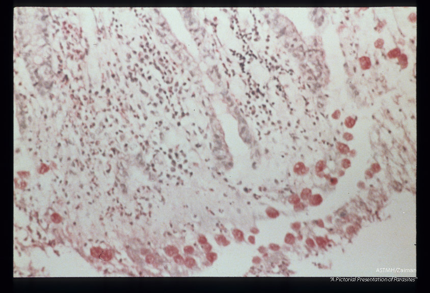 Best carmine stained section of rectum.