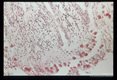 Best carmine stained section of rectum.