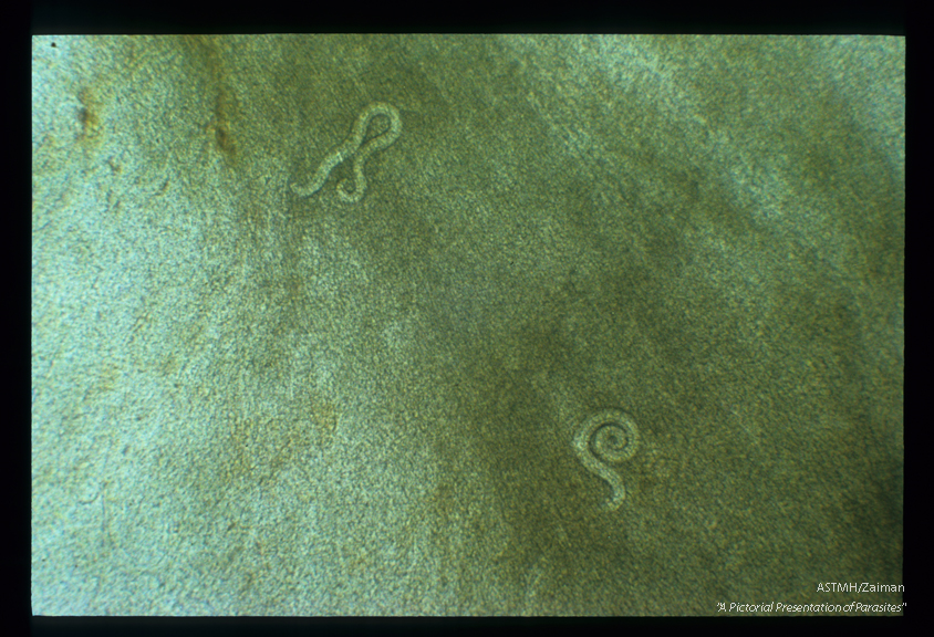 Larvae in squash preparation of brain of an experimentally infected mouse.