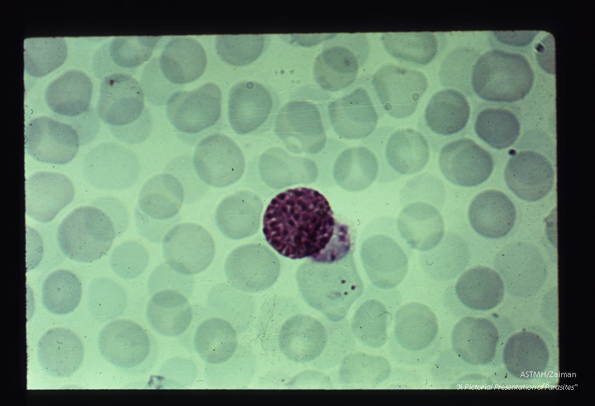 Schizont in peripheral blood showing early stages of division.