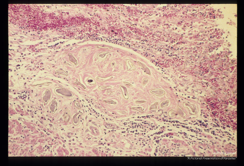 Multiple sections through appendix.