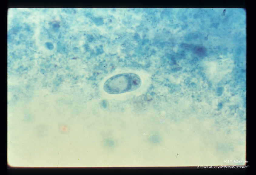 Cyst in stool. Trichrome stain.