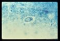 Cyst in stool. Trichrome stain.