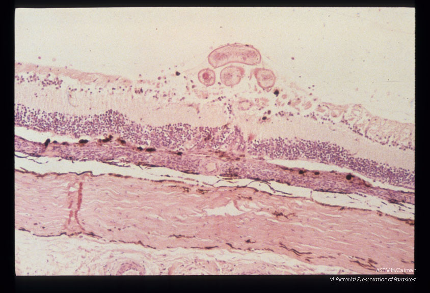 Larva in the inner nerve fiber layer in an experimentally infected squirrel monkey.