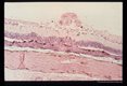 Larva in the inner nerve fiber layer in an experimentally infected squirrel monkey.