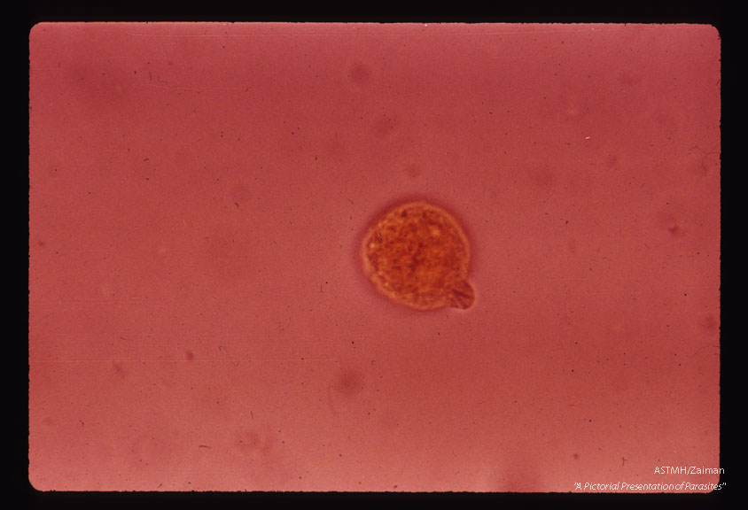 Lee case. Preflagellate.