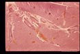 Hepatic portal veins of mouse 28 days after infection.