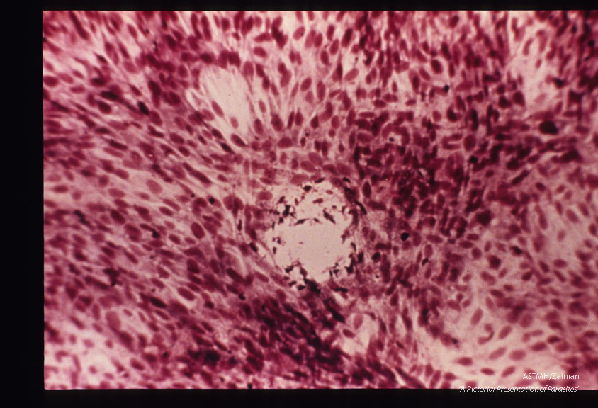 Plaque formation in Hela cells infected with Toxoplasma.