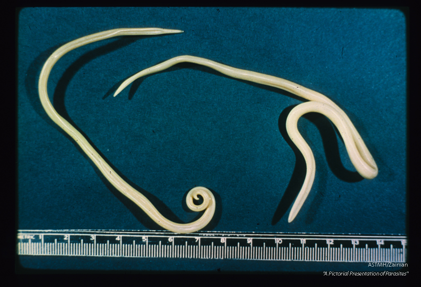 An adult male (coiled posterior end) is shown with a female. The anterior end is more slender than the posterior.