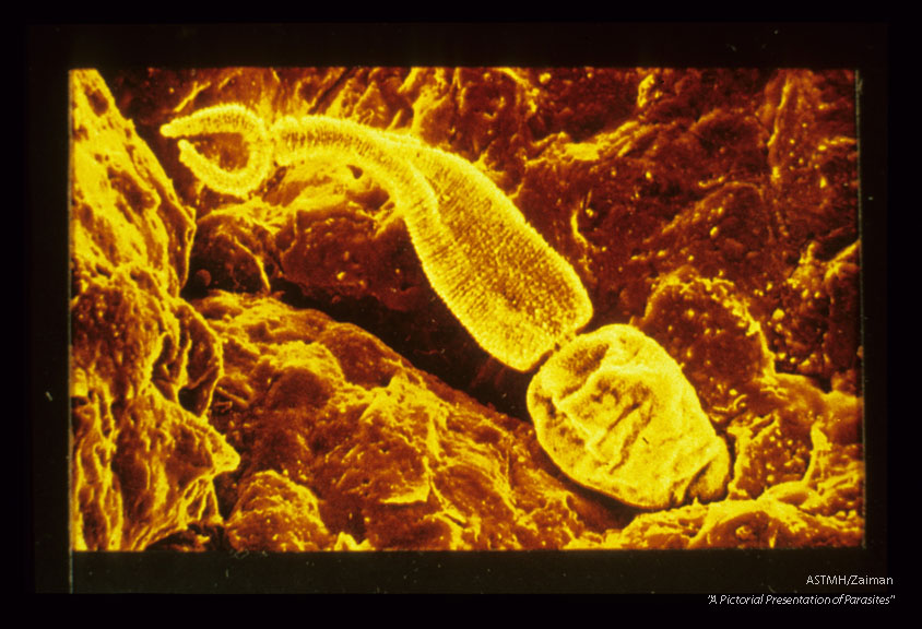 Cercaria making contact with mouse skin. Scanning electron microscope.