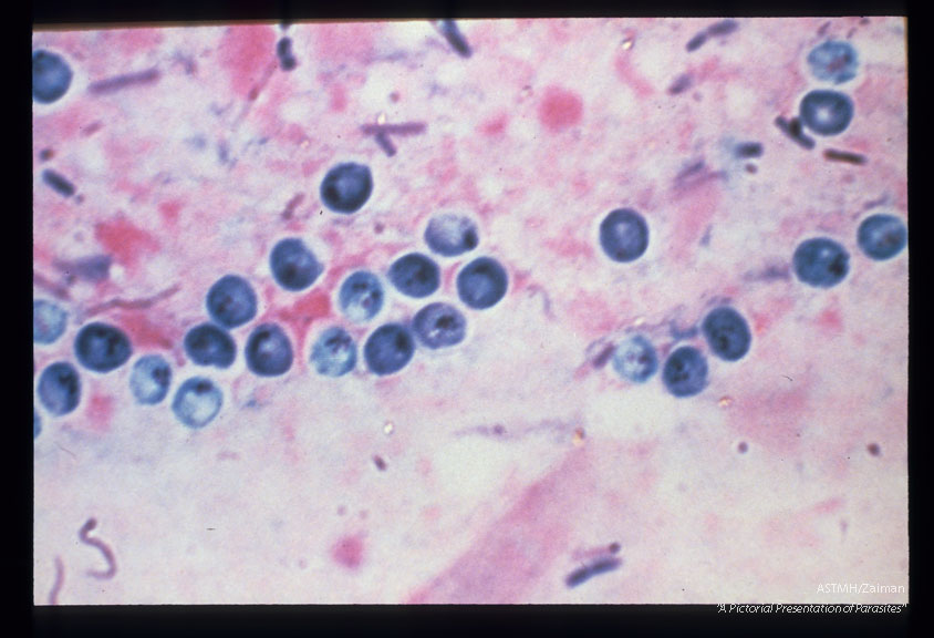 Giemsa stain of stool specimen. '