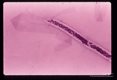 Anterior end of same microfilaria.