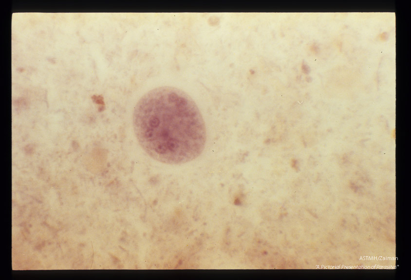 Cysts in stool, showing various numbers of nuclei, hematoxylin stain.