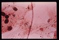 Eggs demonstrated on a single scotch tape preparation taken from an eight year old caucasion female living on isolated rural non-farm land in northern West Virginia. This slide clearly demonstrates that eggs other than Enterobius, may be picked up by the scotch tape technique.