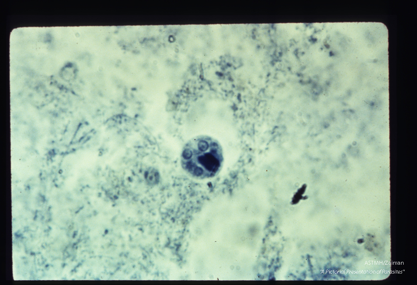 Cyst with four nuclei and chromatoidal bars.