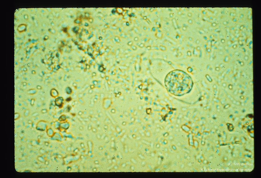 Oocyst with two sporocysts.