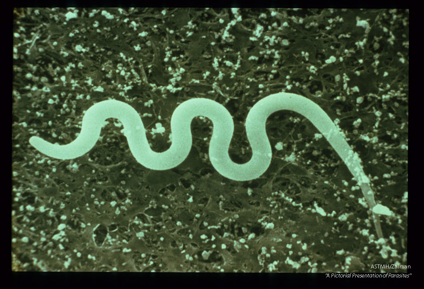 Scanning electron micrograph of a normal microfilaria.