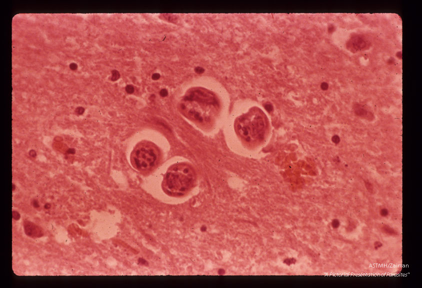 Cross section of nematode in monkey cord showing giant cell formation around worm.