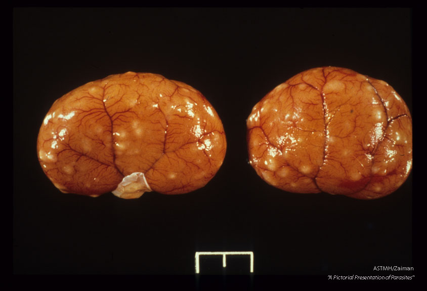 Experimental cat infections. Five thousand infective eggs given per os. Numerous large cortical granulomas on the kidney 36 days after infection.