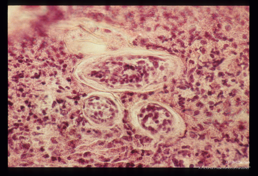 Bladder biopsies from a tourist from Illinois.