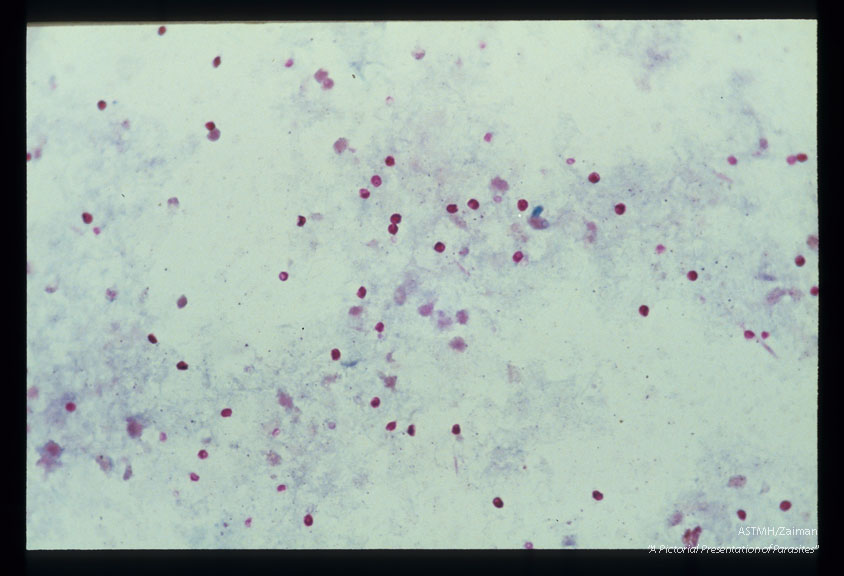 Stool specimens stained by hot acid fast technique.