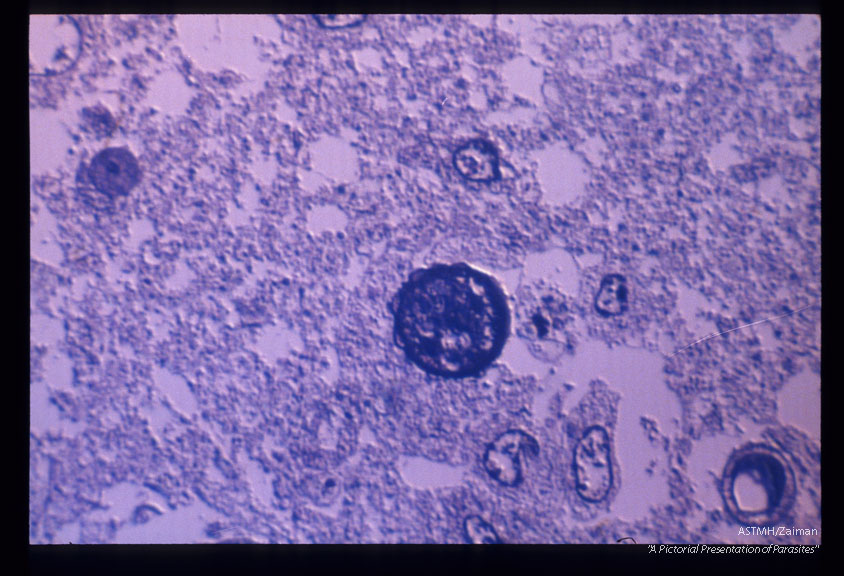 Cyst from a Zambian case. Toluidine blue stain. Nomarski technique.