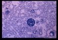 Cyst from a Zambian case. Toluidine blue stain. Nomarski technique.