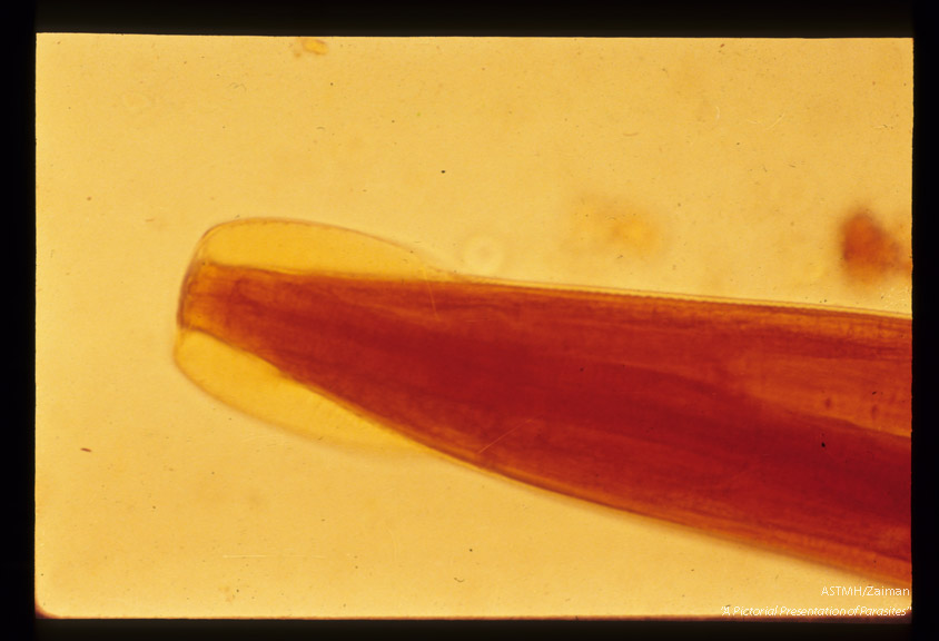 Anterior portion of male showing cervical alae. Iodine stained.
