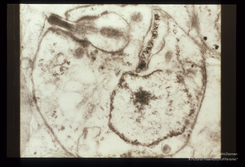 A single specimen showing flagellum, associated structures, and nucleus.